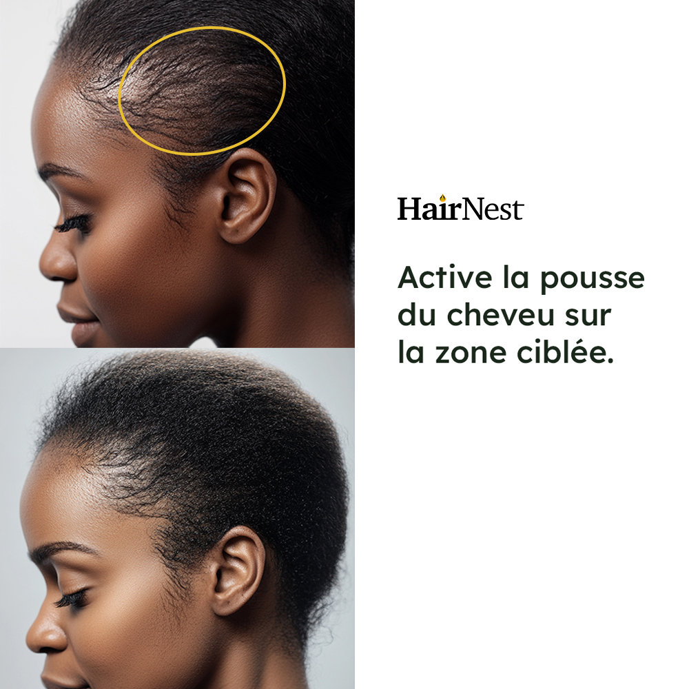 HairNest 100ml – Image 3